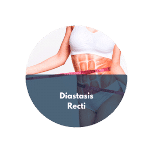 diastasis recti abdominal gap treatments