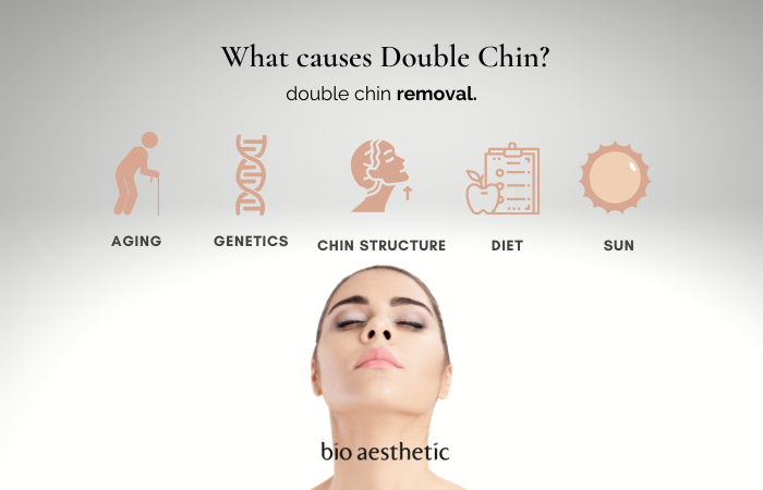 what causes double chin