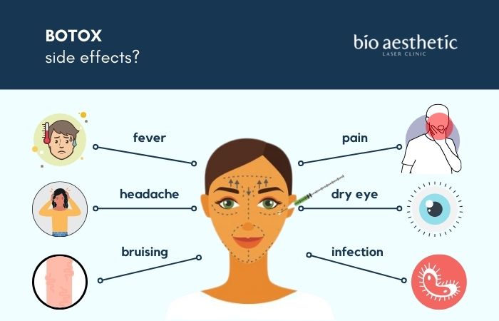 botox side effects